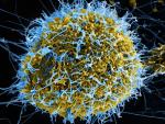 Científicos revelan puntos débiles en las defensas del virus del ébola
