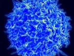 Científicos logran identificar varios genes alterados en los linfomas periféricos de células T