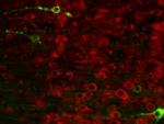 Investigadores desarrollan una molécula  sintética que reduce el daño relacionado con el Alzheimer en ratones