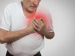 La angioplastia primaria reduce a la mitad la mortalidad por infarto de miocardio
