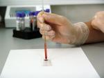 Nuevas pruebas de sangre basadas en genes identifican más cánceres de piel
