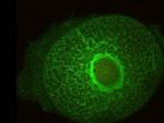 Grupo de Genética Molecular Humana de UCLM descubre un gen que controla el desarrollo embrionario del ojo, cara y cráneo