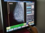 DOCM publica la donación de 14,9 millones de euros de Fundación Amancio Ortega a Sescam para equipamiento de mamografías
