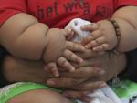 Obesidad y desnutrición, la "doble carga de la malnutrición" en América Latina