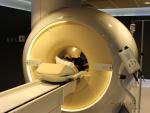 La resonancia magnética permite evitar el 27% de las biopsias por cáncer de próstata, según un estudio