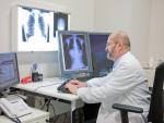 Los hombres necesitan más pruebas de detección del cáncer de pulmón que las mujeres