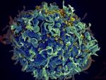 En los pacientes con VIH, la hepatitis C podría empeorar la progresión de la enfermedad asociada al VIH