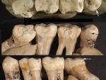 Un análisis de muescas en dientes de Neanderthal revela evidencia de odontología prehistórica