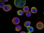 Científicos demuestran que las células tumorales matan a células de la pared vascular para crear metástasis