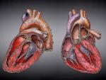 Las enfermedades cardiovasculares causan un tercio de las muertes en todo el mundo