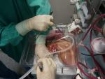 ITAINNOVA participa en un proyecto para la preservación de órganos para trasplante