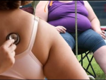 Las personas obesas que llegan a la vejez gozan de una mejor salud según un estudio