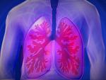 Afectados por hipertensión pulmonar piden mejorar su diagnóstico y evitar que se confunda con otras patologías