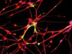El Hospital de Parapléjicos coordina un estudio europeo que probará una terapia para reparar la mielina de las neuronas