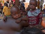 Unos 6,4 millones de niños menores de 5 años padecen malnutrición en el Sahel