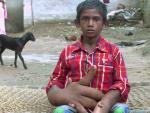Una extraña malformación provoca que las manos de un niño indio pesen más de 12 kilos