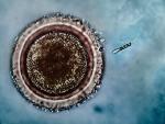 Investigan el interruptor celular que estimula la actividad de las células de esperma