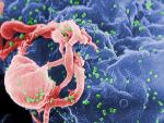 Detectan presencia de VIH en el niño estadounidense que se creía curado