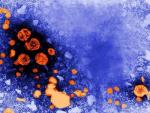 La hepatitis viral mata a tantas personas como la malaria, la tuberculosis o el VIH/sida
