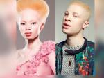 Un concurso de belleza de albinos para luchar contra los prejuicios en Kenia