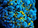 Descubren los factores que favorecen el desarrollo de anticuerpos altamente neutralizantes contra el VIH