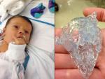 El bebé llamado S. tras la operación que fue preparada con una réplica en 3D de su corazón