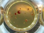La resistencia a los antibióticos aumenta en los microbios "solitarios" mutantes