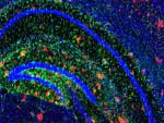 Investigadores revelan cómo las células cerebrales funcionan mal en el Alzheimer