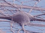 Células madre neuronales de la médula espinal
