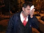 Yavuz Demirag antes de ingresar en el hospital. /Sozcu