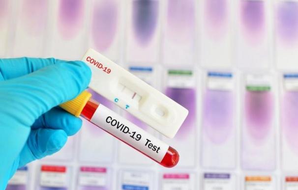 Test PCR coronavirus