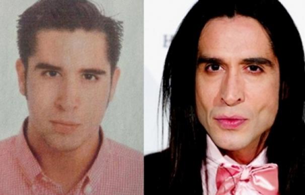 Mario Vaquerizo antes y despues