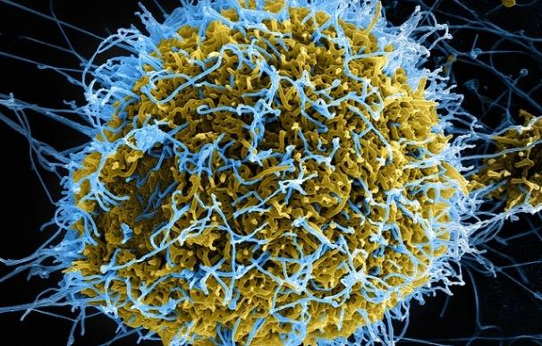 Científicos revelan puntos débiles en las defensas del virus del ébola