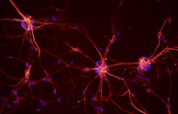 Las células gliales, no las neuronas, son las más afectadas por el envejecimiento cerebral