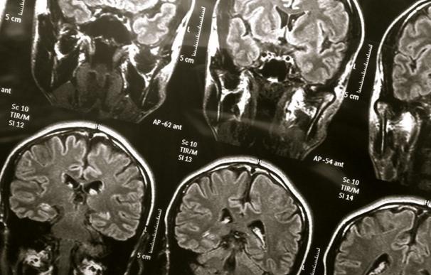 Científicos identifican procesos clave en la respuesta del cerebro al trauma
