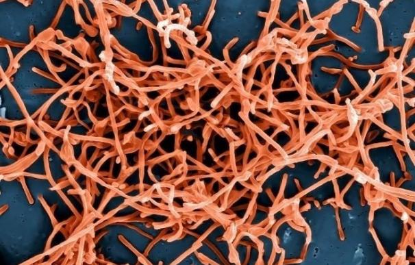 Las personas infectadas con el vírus ébola no siempre muestran síntomas