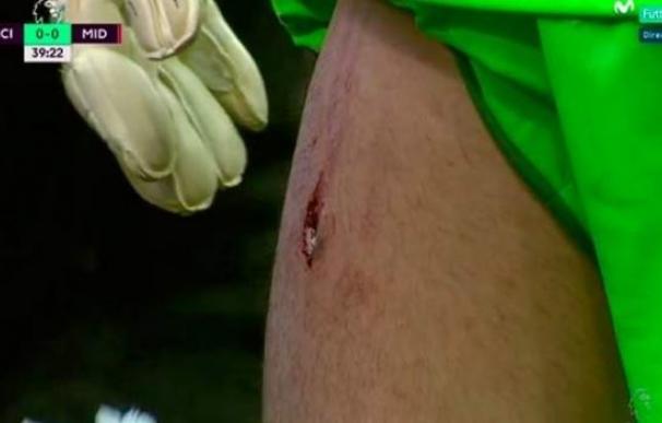 Jesús Navas le abrió un boquete en la pierna a Valdés tras un pisotón