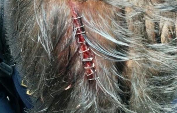 Tres policías fueron atendidos en el CIE de Murcia por brechas en la cabeza tras ser golpeados con barras de hierro