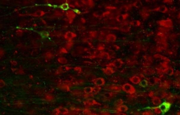 Investigadores desarrollan una molécula sintética que reduce el daño relacionado con el Alzheimer en ratones
