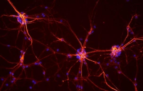 Las alteraciones en las señales neuronales pueden mejorar el diagnóstico de la epilepsia