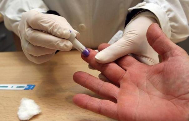 Compromís plantea realizar una prueba rápida en las farmacias para detectar el VIH