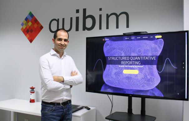 El fondo Tech Transfer UPV realiza su primera inversión de 550.000 euros en la spin-off Quibim
