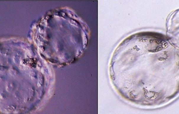 El líquido utilizado en el laboratorio para la fecundación influye en la aparición de problemas en el embrión