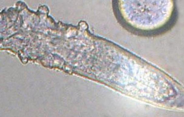 Los Demodex son un tipo de ácaro microscópico que suele vivir en los folículos del pelo