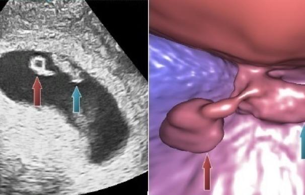 Investigadores desarrollan la primera técnica para realizar ecografías virtuales en embriones recién implantados