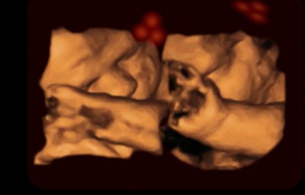 Los fetos en desarrollo reaccionan a formas similares a la cara desde el útero