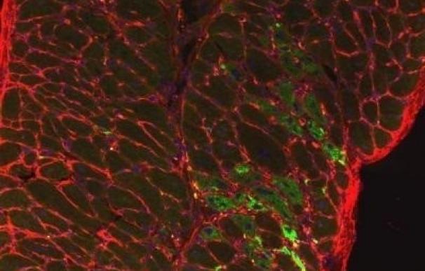 Investigadores recurren a una antigua terapia experimental contra el cáncer para tratar la distrofia muscular