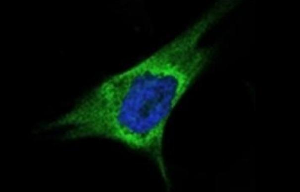 Identifican un nuevo mecanismo de actuación de una proteína en la progresión tumoral