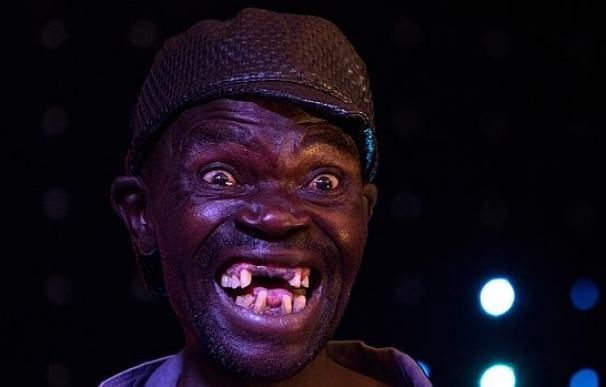 El ganador del concurso de feos de Zimbabue