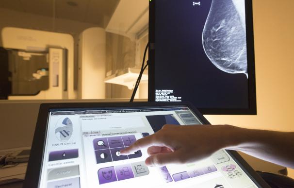 La Unidad de Mama de Mesa del Castillo incorpora la 'Imagen Sintetizada' a la Mamografía 3D